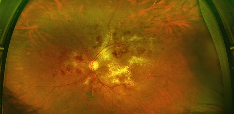 The Connection Between Eye Health and Chronic Conditions